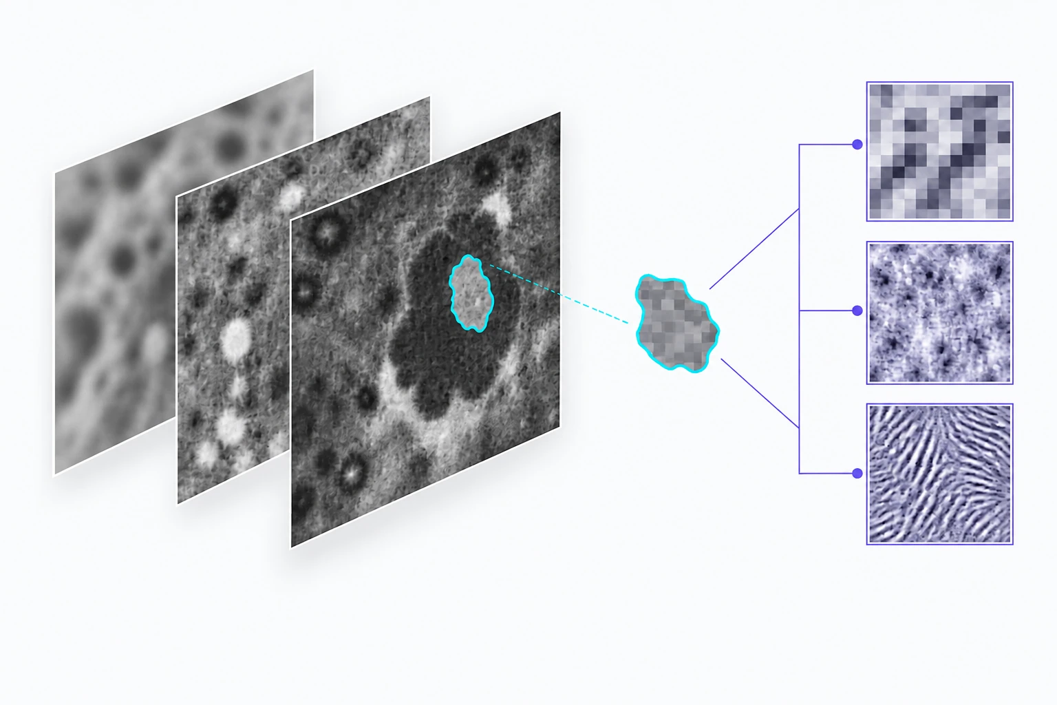 Diagram of region segmentation and multiscale image features for pancreatic cyst research.