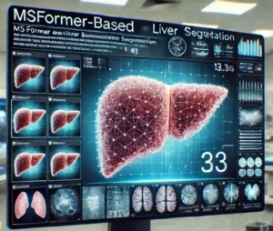 ENHANCING LIVER SEGMENTATION OUTCOMES WITH MSFORMER-BASED ARTIFICIAL INTELLIGENCE SYSTEM