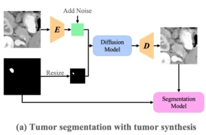Optimizing Synthetic Data for Enhanced Pancreatic Tumor Segmentation